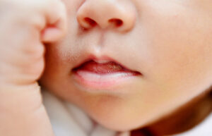 Muere guagua de siete meses luego que sus padres le recetaran dieta sin gluten y medicina homeopática