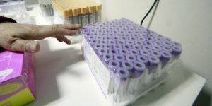 Instituto de Salud Pública confirmó presencia de lepra en paciente de la Región de Los Lagos