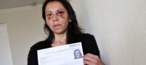 Víctima de violencia intrafamiliar debió renovar foto de carnet con lesiones en su rostro