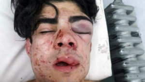 Ataque xenófobo en Argentina: creyeron joven era chileno y lo golpearon hasta quedar desfigurado