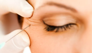 Toxina presente en el bótox y tratamiento para el bruxismo degrada los huesos