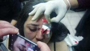 Estudiante de U. Iberoamericana herida con perdigones tras accionar de Carabineros