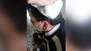 Chimbarongo: apoderado golpea con una silla en la cabeza a profesor frente a alumnos