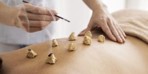 Diputado de Evópoli quiere que Fonasa cubra la acupuntura, reiki y el uso de imanes