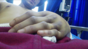 Denuncian ataque homofóbico a estudiante de la U. de Chile