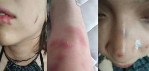 Movilh denuncia ataque contra pareja de lesbianas en el Barrio Bellavista