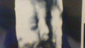 La insólita explicación de ginecólogo tras entregar la misma ecografía a todas sus pacientes