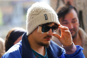 Minsal anuncia Programa Integral de Reparación Ocular para heridos en marchas