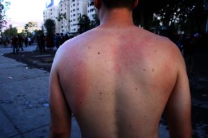 Carabineros reconoce 