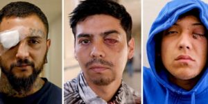 Reportaje de The New York Times sobre traumas oculares en Chile es finalista de World Press Photo 2020