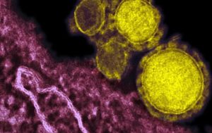 Estados Unidos: suspenden importante conferencia sobre el coronavirus por temor a contagiarse