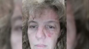 Coronavirus en Argentina: enfermera es golpeada y rociada con desinfectante por vecino