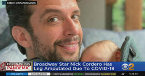 Actor estadounidense pierde una pierna a causa del coronavirus