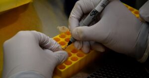 Laboratorio de Ovalle suspende realización de exámenes por COVID-19