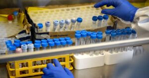 Falla en laboratorio de Antofagasta deja casi 800 muestras de PCR en espera