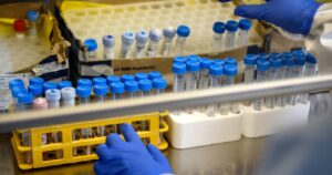 Argentina anunció creación de un test rápido para detectar coronavirus