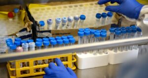 Región del Biobío: 1.354 casos acumulados y 867 recuperados de coronavirus