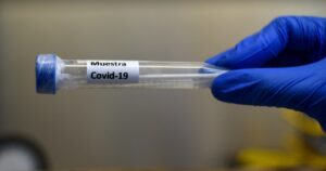 Gobierno reporta 45 muertos y 3.709 contagiados en las últimas 24 horas