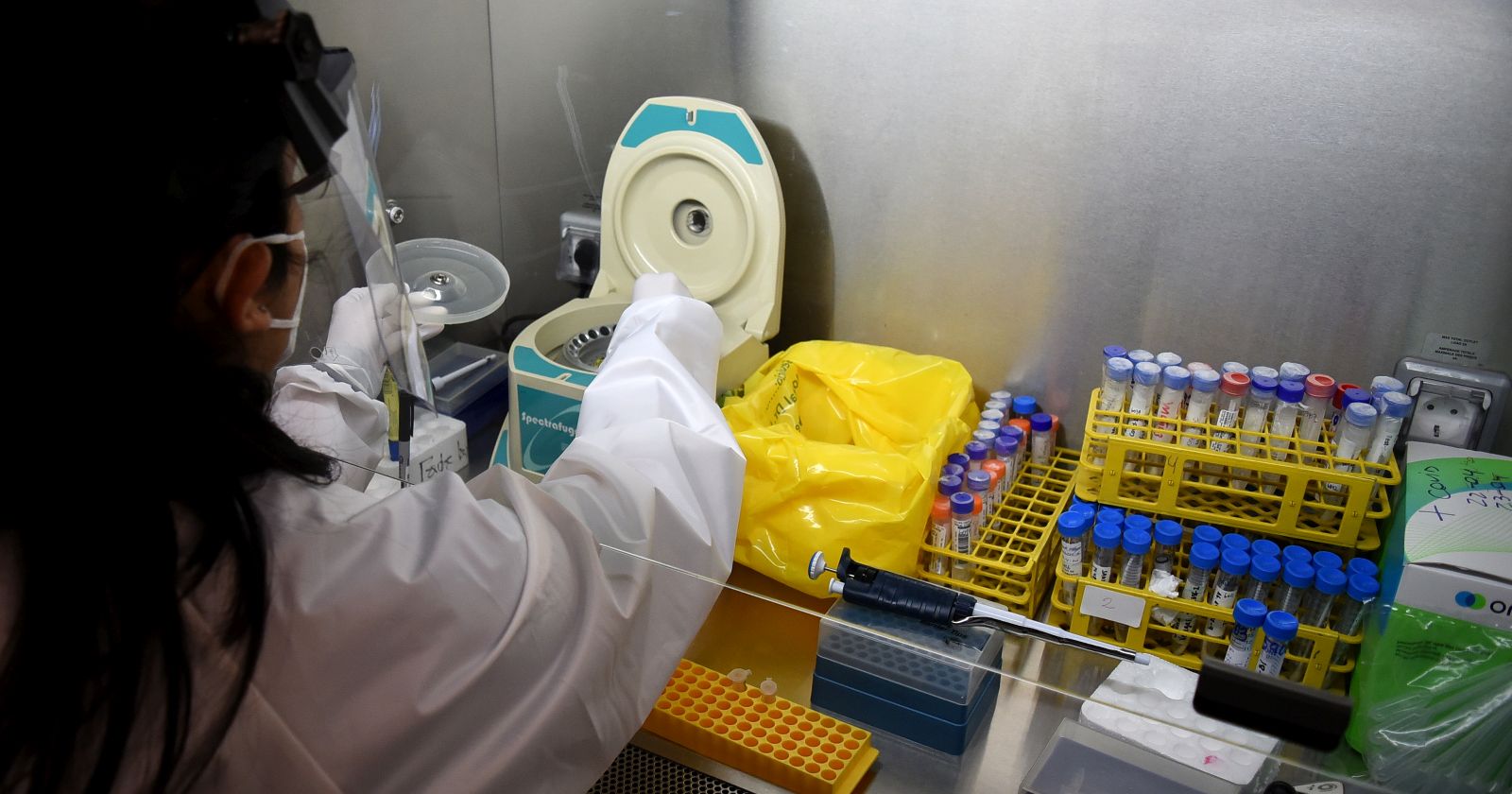 proteína coronavirus