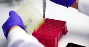 Minsal anuncia nueva forma de testeo de COVID-19 a través de la saliva