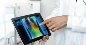 E-Tórax: la plataforma digital que detecta signos patológicos respiratorios