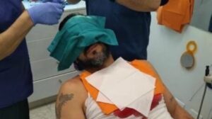 Fiscalía identifica y formalizará a agresor de Rafael Cavada en marcha del 