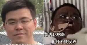 Murió médico de Wuhan que cambió de color de piel tras sufrir coronavirus