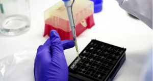 Minsal busca realizar tests PCR a domicilio para disminuir tiempos de detección