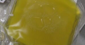 Hospital Clínico de la U. de Chile iniciará tratamiento experimental con plasma en pacientes con COVID-19