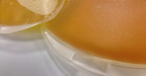 Bolivia planea ley para obligar a recuperados de COVID-19 a que donen plasma