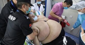 Hombre engordó 100 kilos tras pasar cinco meses en cuarentena en Wuhan