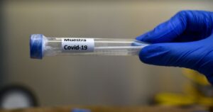 Experto italiano: coronavirus se está debilitando y podría “morir” sin vacuna