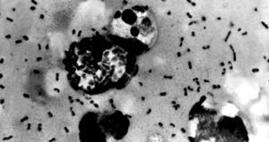 ¿Es posible que la peste bubónica llegue a Chile?