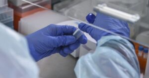 Investigación afirma que la mitad de la población tendría linfocitos-T que reconocen al coronavirus