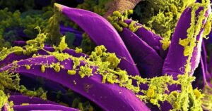 Detectan el primer caso de peste bubónica en California tras cinco años