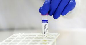 Minsal estudia posible contaminación en los laboratorios de Magallanes