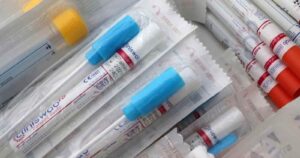 Oxford y AstraZeneca reanudarán ensayos de su vacuna contra el coronavirus