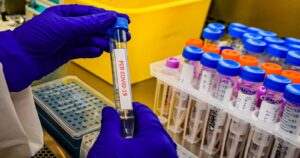 Punta Arenas se mantiene como la comuna con más casos activos de COVID-19 en el país