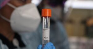 Minsal reporta 1.567 casos nuevos de COVID-19 y anuncia cuarentena total para Villarrica