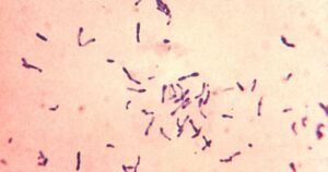 Perú detectó el primer caso de difteria en 20 años en medio de la pandemia