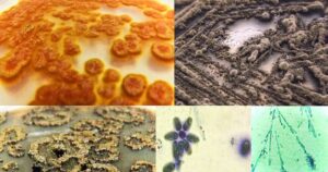 Investigadora chilena desarrolla superalimento basado en hongos y algas marinas