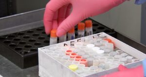 Detectan peligroso virus en Bolivia que puede transmitirse entre humanos