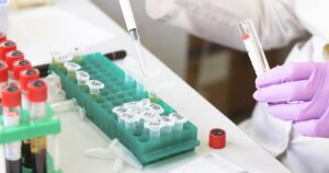 Capital Economics: Chile es el único país de América Latina capaz de llegar a la vacunación en 2021