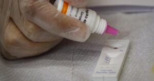 Día Mundial del Sida: 10 mil diagnosticados no reciben tratamiento