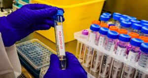 Detectan nuevo caso de la variante británica del coronavirus en Curicó