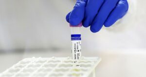 Descubren a paciente con 