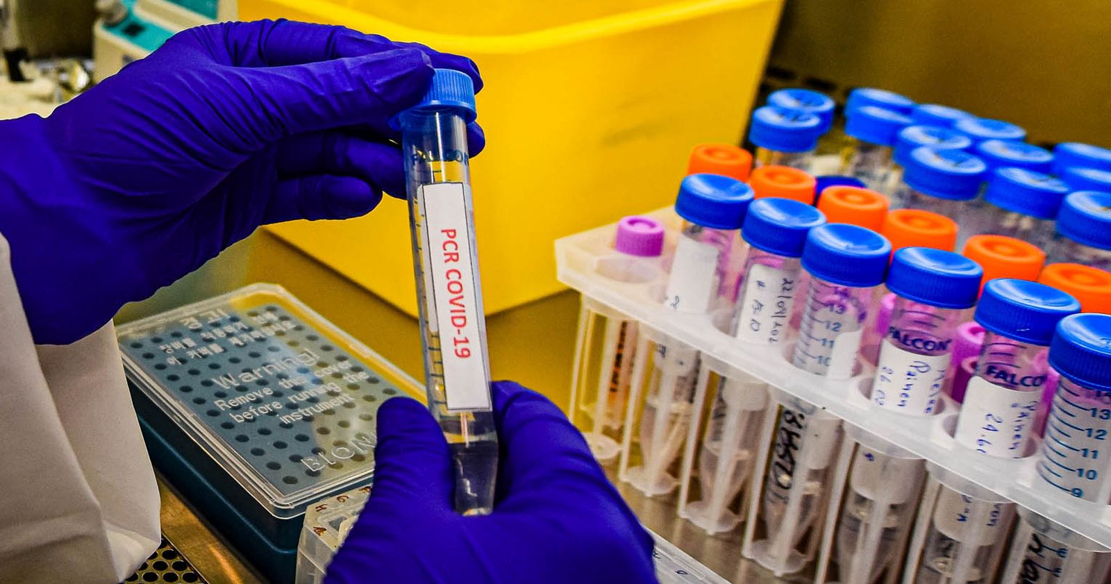 COVID-19 laboratorio