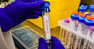 Argentina suma cerca de 7.900 casos de coronavirus en la última jornada