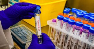 Minsal confirmó el primer caso de variante sudafricana de COVID-19 en Chile