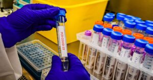 Informe epidemiológico: Región Metropolitana baja levemente en sus casos activos de COVID-19